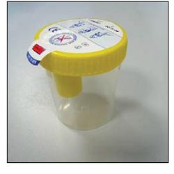 Kit Contenitore Urina Secur Box Tappo Giallo A Vite Con Punto Di Prelievo 120 Ml 1 Pezzo - Lovesano