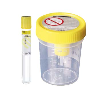 MEDIPRESTERIL CONT URINA+PROVE - Lovesano