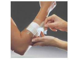 OPSITE FLEXIFIX 5X1000 1MED - Lovesano