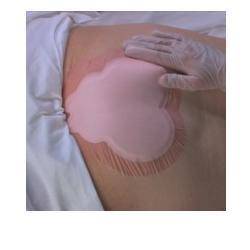 ALLEVYN SACRUM 22,5X22,1 10PZ - Lovesano