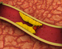 Armolipid Plus: tieni a bada il colesterolo cattivo