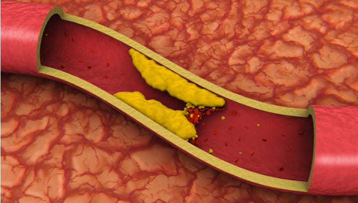 Armolipid Plus: tieni a bada il colesterolo cattivo